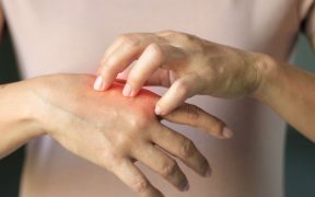 Lupus symptoms to look out for - three most common signs of Lupus and 11 symptoms to be aware of