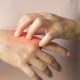 Lupus symptoms to look out for - three most common signs of Lupus and 11 symptoms to be aware of