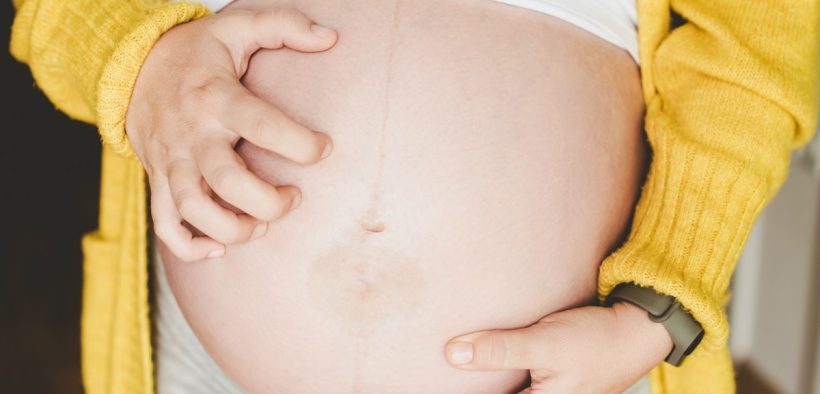 Your Guide To Pregnancy Eczema: Symptoms, Causes, & Treatment