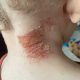 Eczema miracle on TikTok: Grahams Natural praised by family for their life-changing natural skin care products