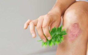 Eczema Therapeutics