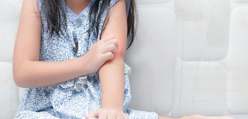 The Burden of Itch for Pediatric Patients and Parents