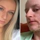 'Topical steroid withdrawal after treating eczema left me feeling worthless'