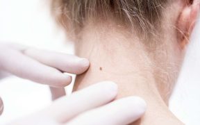 At-Home Solutions to Four Common Skin Concerns, According to Dermatologists