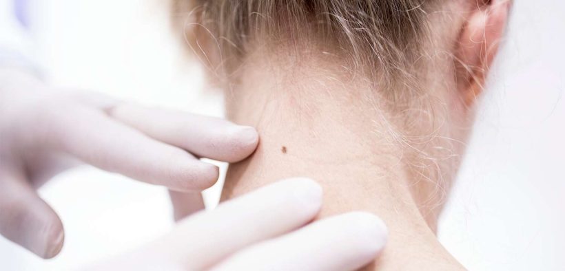 At-Home Solutions to Four Common Skin Concerns, According to Dermatologists