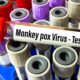 First U.S. Monkeypox Death Reported in Texas - Consumer Health News