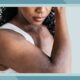 Eczema in Black Skin: Symptoms, Diagnosis, Treatment