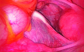 How to make Eczema Care Online freely available