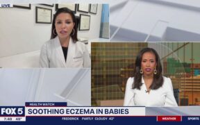 Tips to help sooth eczema in babies - FOX 5 DC