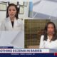 Tips to help sooth eczema in babies - FOX 5 DC