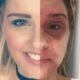 'Rollercoaster to hell': Woman's skin condition nightmare