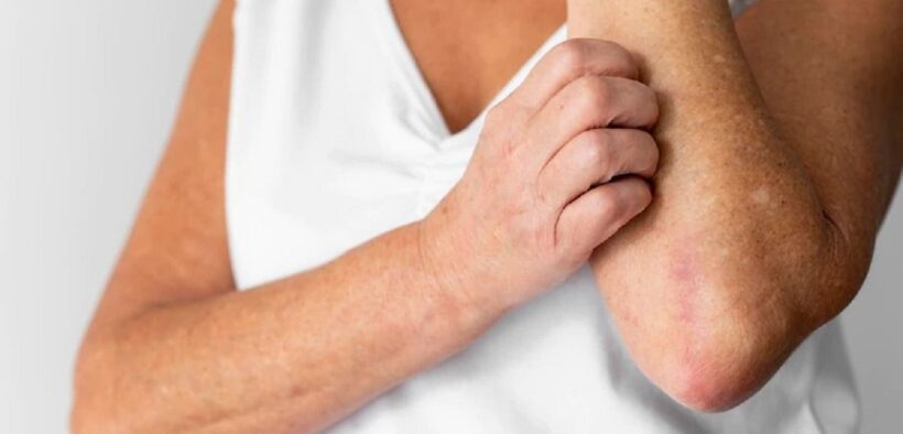 6 measures to maintain skin health for diabetics during monsoon