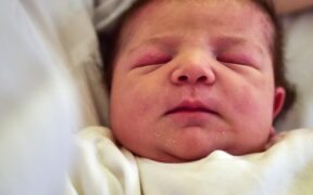 I'm A Dermatologist, These Are The Most Common Skin Issues In Babies