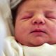 I'm A Dermatologist, These Are The Most Common Skin Issues In Babies