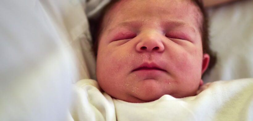 I'm A Dermatologist, These Are The Most Common Skin Issues In Babies