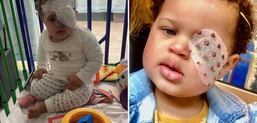 Doctors misdiagnosed baby's cancer as eczema, she lost an eye