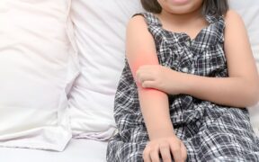 Is it eczema or psoriasis? An expert offers advice