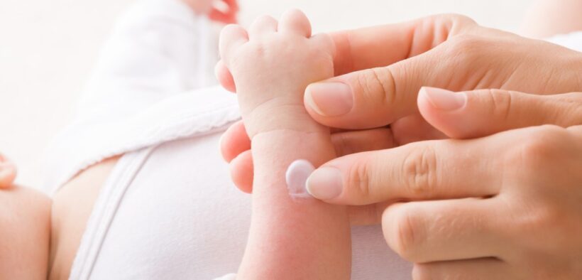 Shop This Eczema Balm That’s 40% Off for Prime Day & Has Quick Results – SheKnows