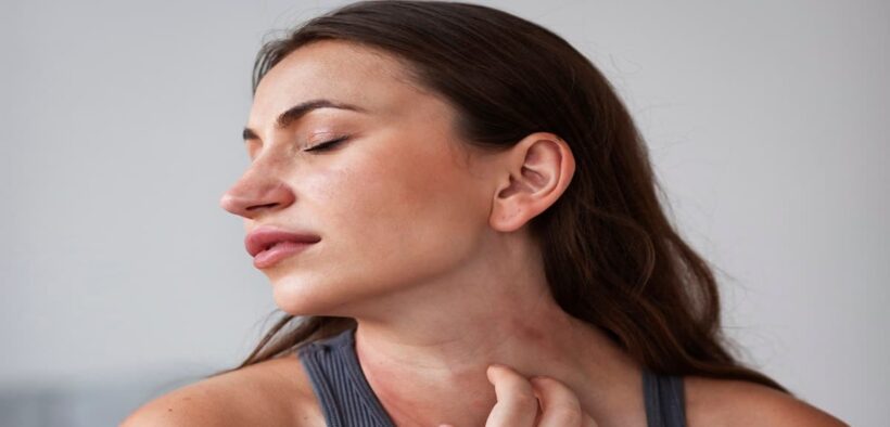 Dermatitis is not just skin-deep: A common skin condition, it can be irritating and painful - Healthcare News