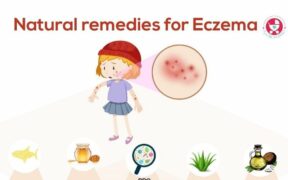 Home Remedies for Eczema: Dermatologist-Approved DIY Treatments
