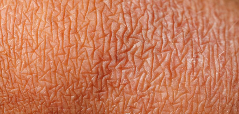 NEA Magazine — Summer 2024 - National Eczema Association